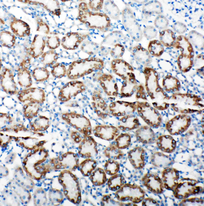 TRAM1 Antibody in Immunohistochemistry (Paraffin) (IHC (P))
