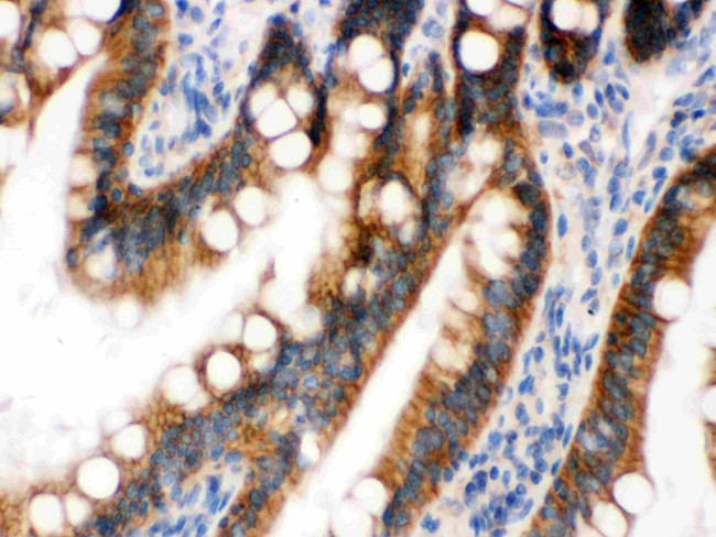 UPF1 Antibody in Immunohistochemistry (Paraffin) (IHC (P))