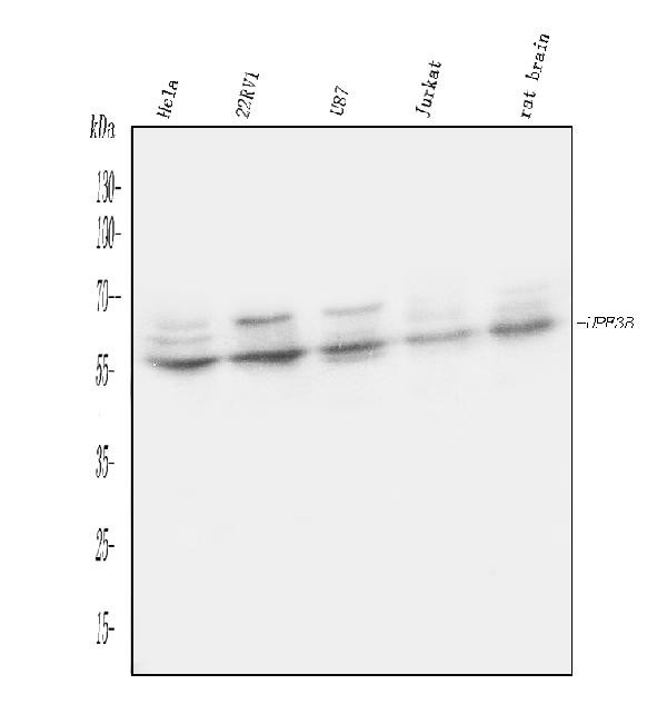 UPF3B Antibody in Western Blot (WB)