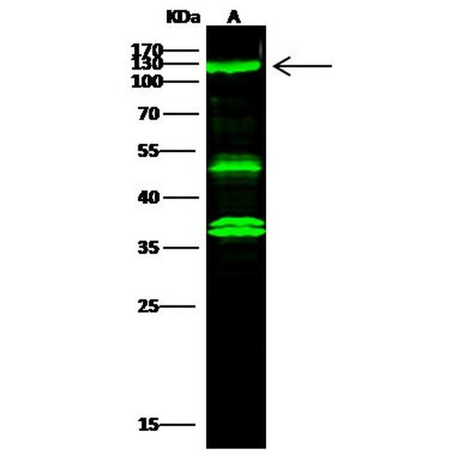 ATP Citrate Lyase Antibody in Western Blot (WB)