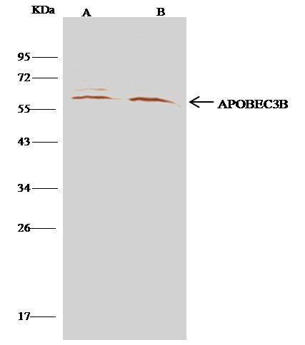 APOBEC3B Antibody in Immunoprecipitation (IP)