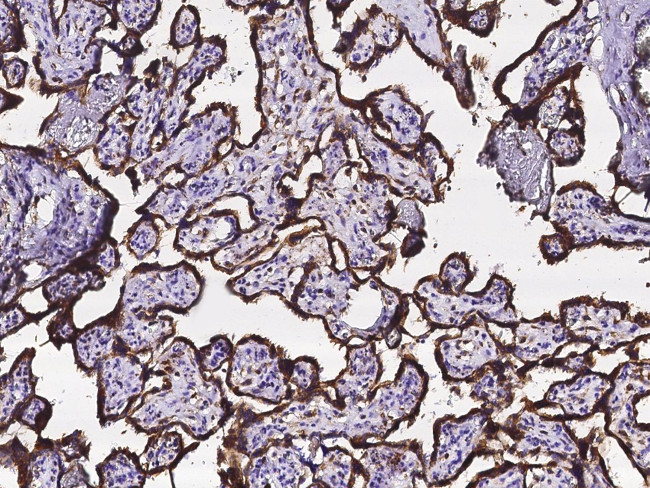 Calreticulin Antibody in Immunohistochemistry (Paraffin) (IHC (P))