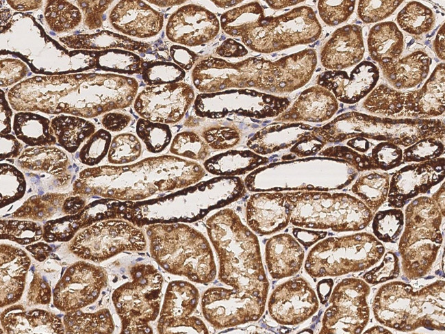 Citrate Synthase Antibody in Immunohistochemistry (Paraffin) (IHC (P))