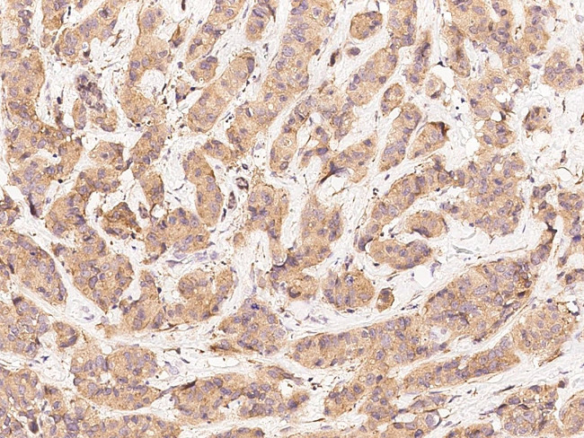 ErbB3 Antibody in Immunohistochemistry (Paraffin) (IHC (P))