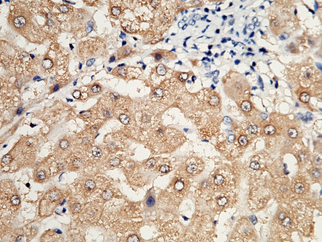 HAGH Antibody in Immunohistochemistry (Paraffin) (IHC (P))