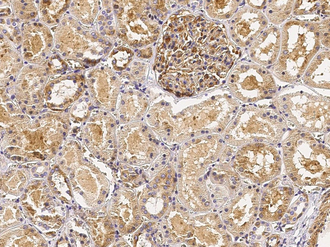 CD51 Antibody in Immunohistochemistry (Paraffin) (IHC (P))