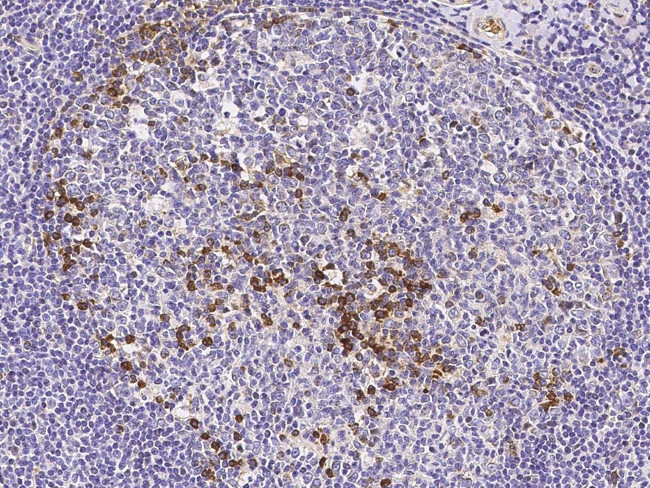 CD51 Antibody in Immunohistochemistry (Paraffin) (IHC (P))