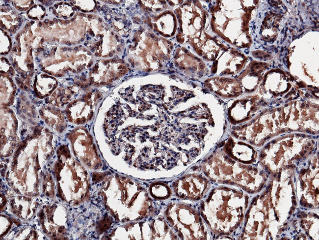 NBL1 Antibody in Immunohistochemistry (Paraffin) (IHC (P))