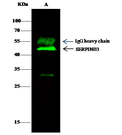 SERPINB3 Antibody in Immunoprecipitation (IP)