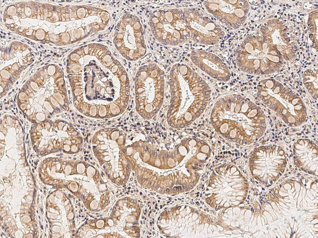 SLC27A5 Antibody in Immunohistochemistry (Paraffin) (IHC (P))