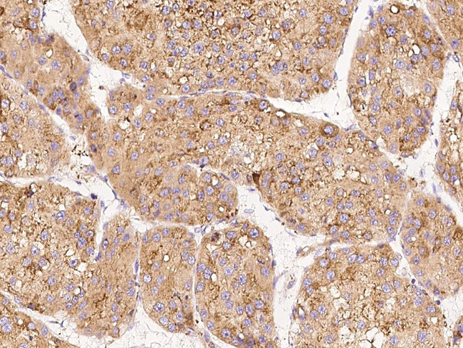 LYK5 Antibody in Immunohistochemistry (Paraffin) (IHC (P))