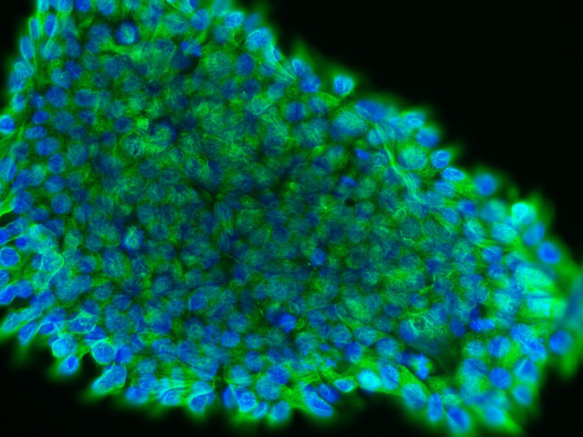 beta-3 Tubulin Antibody in Immunocytochemistry (ICC/IF)