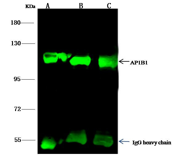 beta-1 Adaptin Antibody in Immunoprecipitation (IP)