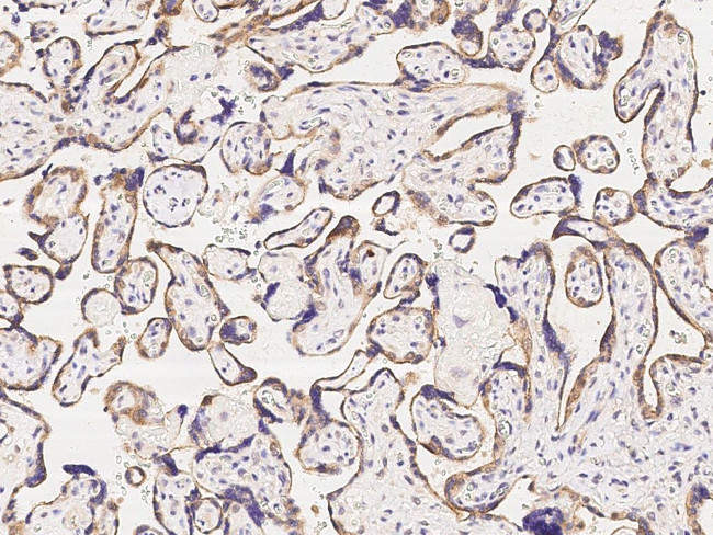 CCDC6 Antibody in Immunohistochemistry (Paraffin) (IHC (P))