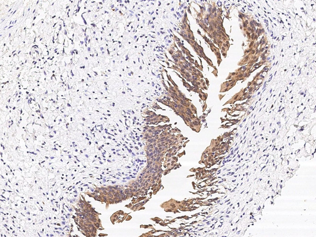 CCDC6 Antibody in Immunohistochemistry (Paraffin) (IHC (P))