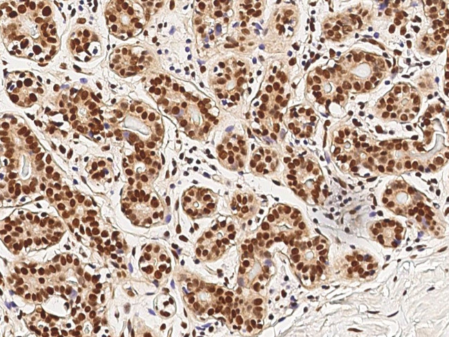 Myb Antibody in Immunohistochemistry (Paraffin) (IHC (P))