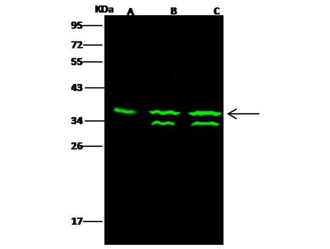 Thymidylate Synthase Antibody in Western Blot (WB)