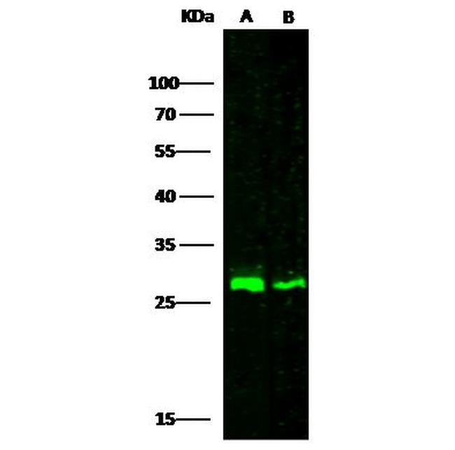 Cathepsin A Antibody in Western Blot (WB)