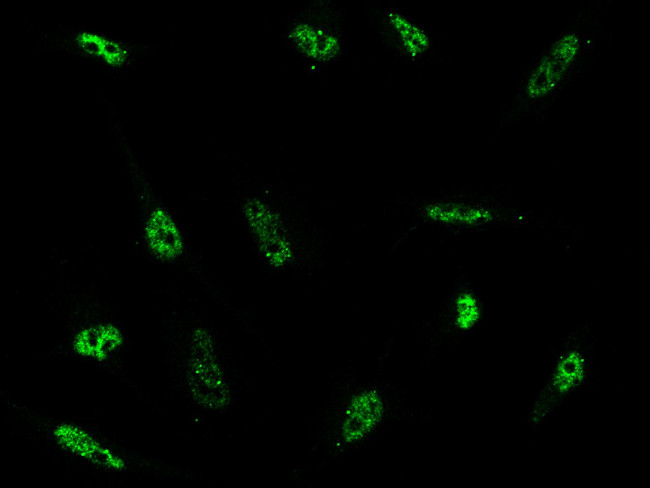 CD178 Antibody in Immunocytochemistry (ICC/IF)