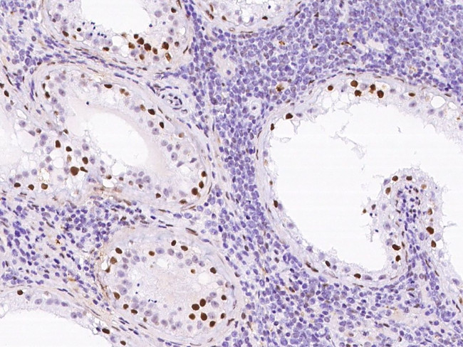 HP1 beta Antibody in Immunohistochemistry (Paraffin) (IHC (P))