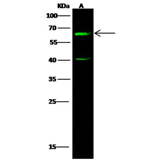 CBX2 Antibody in Western Blot (WB)