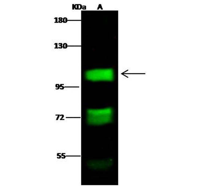 NR3C2 Antibody in Western Blot (WB)