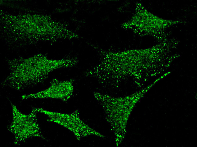 PKN1 Antibody in Immunocytochemistry (ICC/IF)