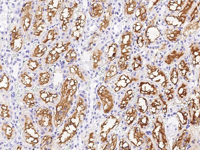 GGT1 Antibody in Immunohistochemistry (Paraffin) (IHC (P))