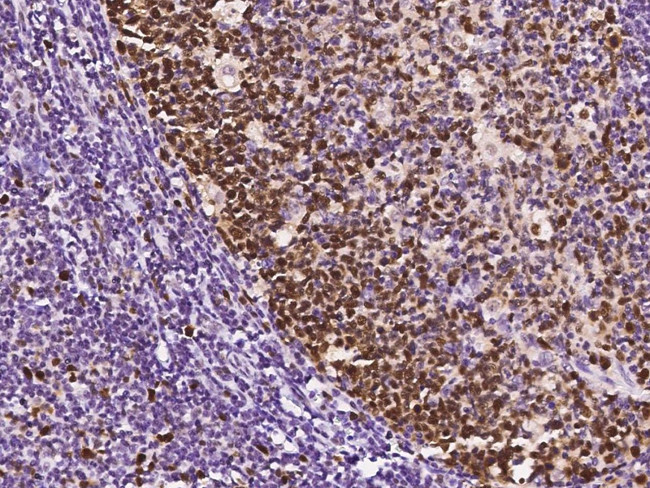 PCNA Antibody in Immunohistochemistry (Paraffin) (IHC (P))