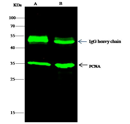 PCNA Antibody in Immunoprecipitation (IP)