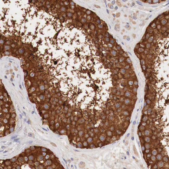 G6PD Antibody in Immunohistochemistry (Paraffin) (IHC (P))