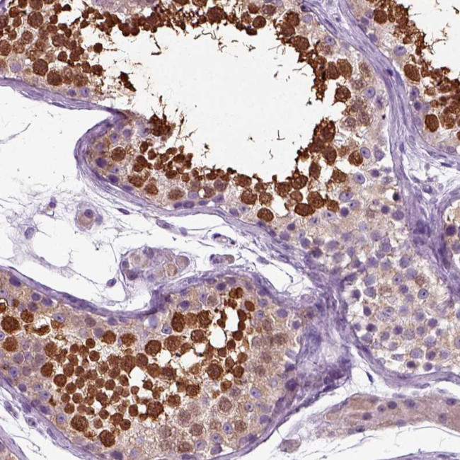 HSPA2 Antibody in Immunohistochemistry (Paraffin) (IHC (P))