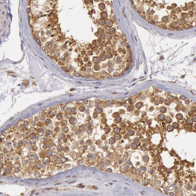 IKK alpha Antibody in Immunohistochemistry (Paraffin) (IHC (P))