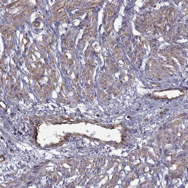 MYH9 Antibody in Immunohistochemistry (Paraffin) (IHC (P))