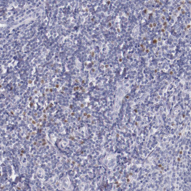 IRF4 Antibody in Immunohistochemistry (Paraffin) (IHC (P))