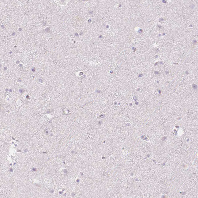 CD206 Antibody in Immunohistochemistry (Paraffin) (IHC (P))