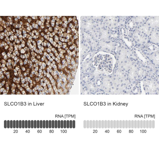 OATP8 Antibody