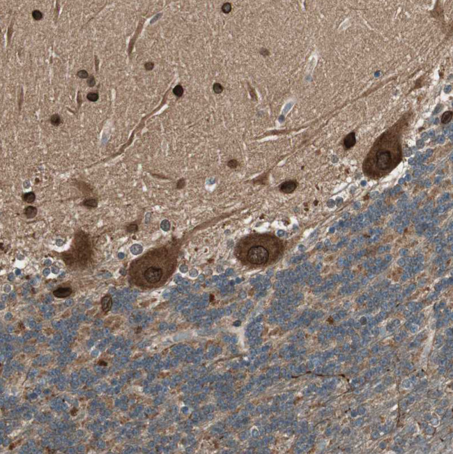 CNOT4 Antibody in Immunohistochemistry (Paraffin) (IHC (P))