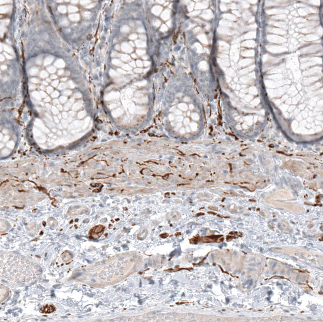 CD171 Antibody in Immunohistochemistry (Paraffin) (IHC (P))