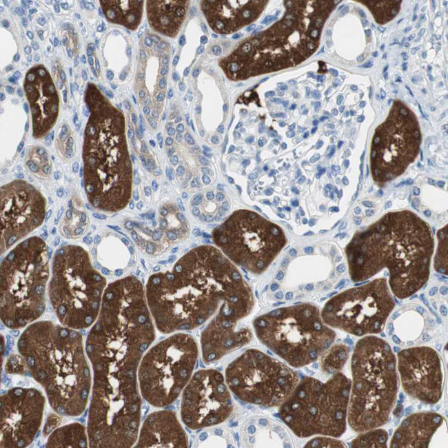 FBP1 Antibody in Immunohistochemistry (Paraffin) (IHC (P))