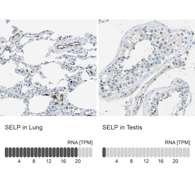 P-Selectin Antibody