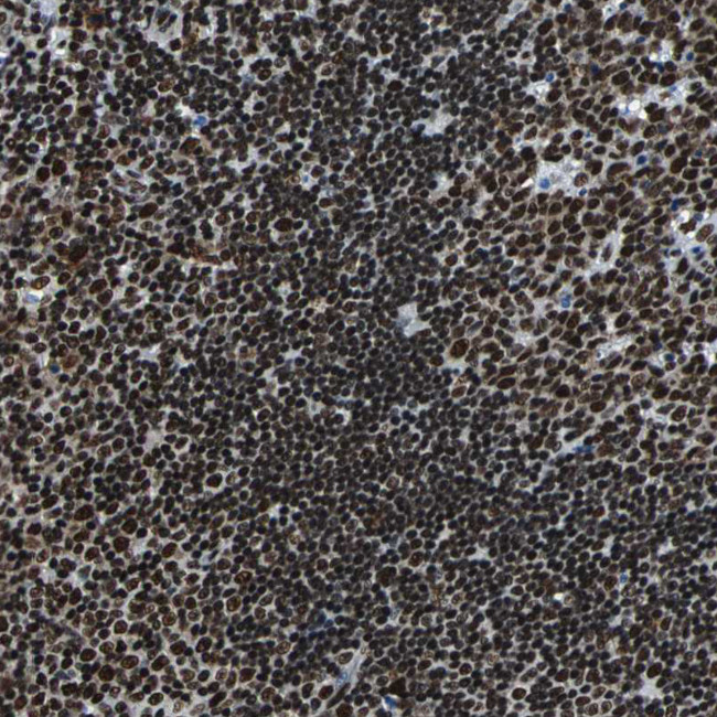 FUBP1 Antibody in Immunohistochemistry (Paraffin) (IHC (P))