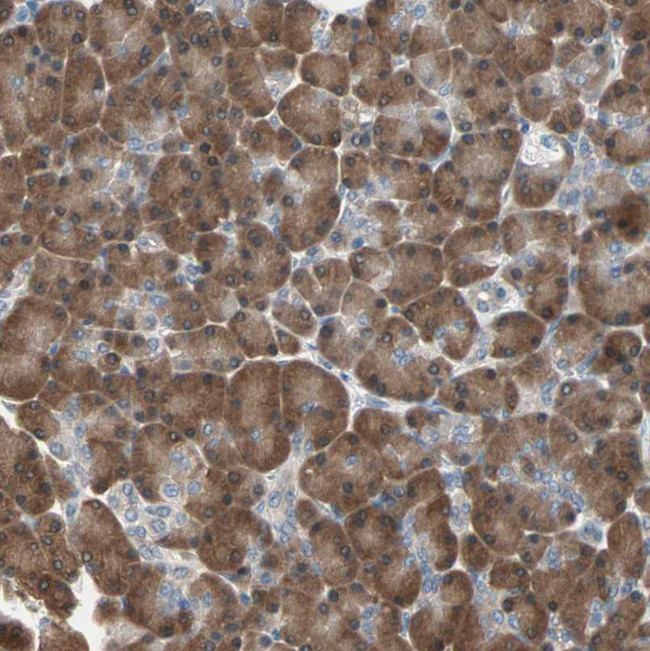 MPI Antibody in Immunohistochemistry (Paraffin) (IHC (P))