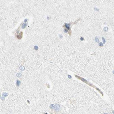 NFkB p100 Antibody in Immunohistochemistry (Paraffin) (IHC (P))