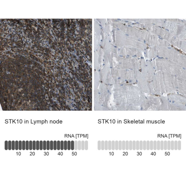 LOK Antibody