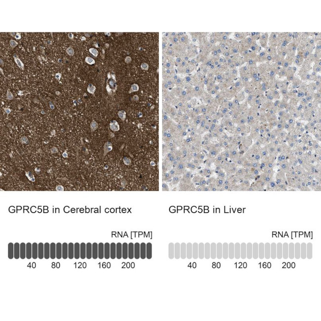 GPRC5B Antibody