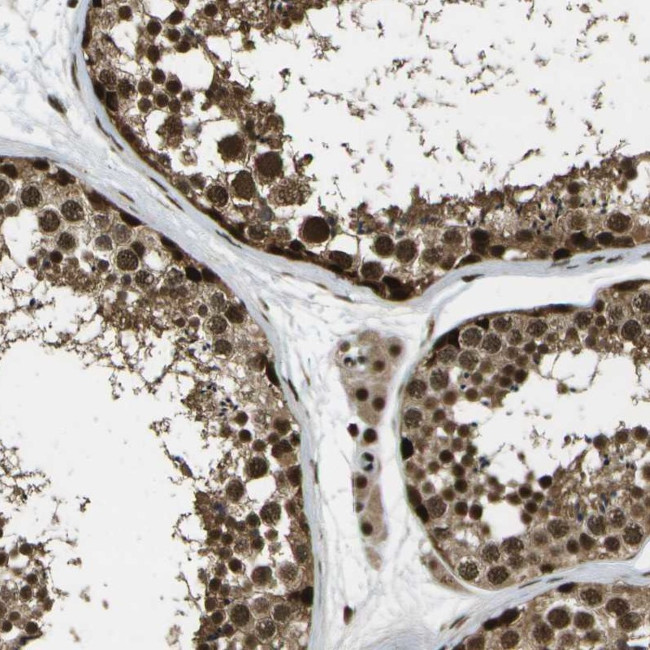 GANC Antibody in Immunohistochemistry (Paraffin) (IHC (P))