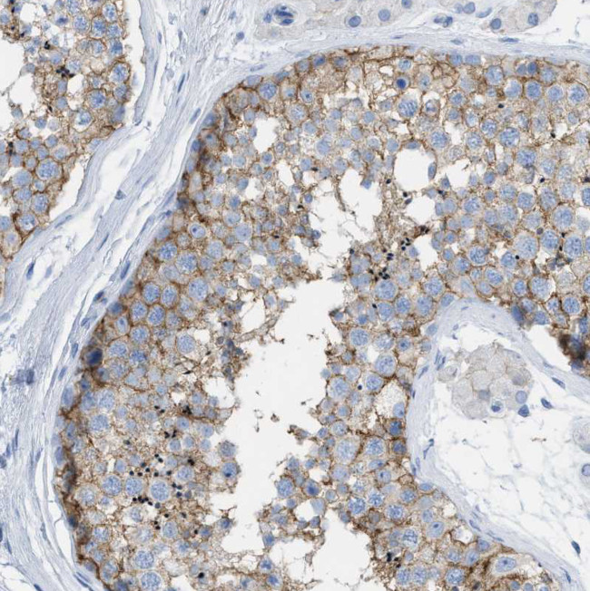 CD98 Antibody in Immunohistochemistry (Paraffin) (IHC (P))