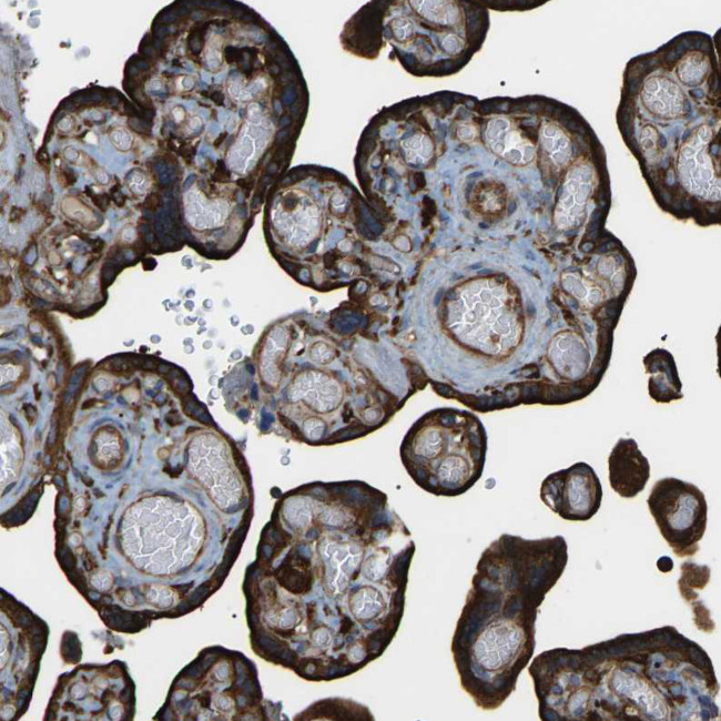 CALM Antibody in Immunohistochemistry (Paraffin) (IHC (P))