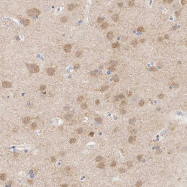 MPP2 Antibody in Immunohistochemistry (Paraffin) (IHC (P))